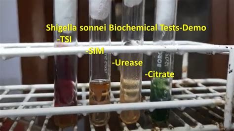 shigella sonnei biochemical tests|Shigella .